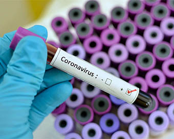 Delhi records 1,246 more coronavirus cases, 40 deaths